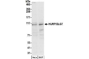 anti-Discs, Large (Drosophila) Homolog-Associated Protein 5 (DLGAP5) (AA 200-250) antibody