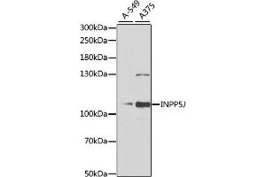 Western blot analysis of extracts of various cell lines, using INPP5J antibody (ABIN6132490, ABIN6142471, ABIN6142472 and ABIN6222324) at 1:1000 dilution. (INPP5J Antikörper  (AA 60-360))