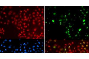 Immunofluorescence analysis of GFP-RNF168 transgenic U2OS cells using DNA polymerase eta Polyclonal Antibody (POLH Antikörper)