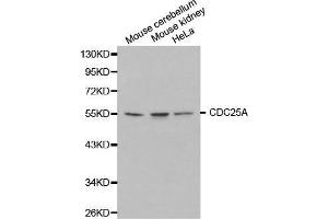 Western blot analysis of extracts of various cell lines, using CDC25A antibody. (CDC25A Antikörper  (AA 235-484))