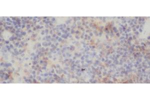 Immunohistochemistry of paraffin-embedded Rat spleen using RELB Polyclonal Antibody at dilution of 1:50 (RELB Antikörper)