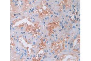 Used in DAB staining on fromalin fixed paraffin- embedded kidney tissue (Tec Protein Tyrosine Kinase (TEC) (AA 370-623) Antikörper)