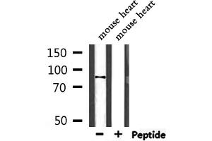 Western blot analysis of extracts from mouse heart, using NEB2 Antibody. (PPP1R9B Antikörper  (C-Term))
