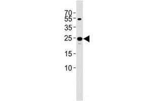 Western blot analysis of lysate from 293T cell line using TFAM antibody diluted at 1:1000. (TFAM Antikörper  (AA 216-246))