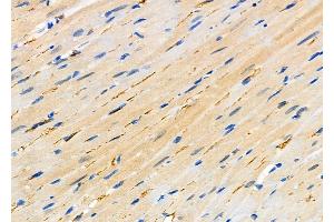 ABIN6265213 and ABIN6276429 at 1/100 staining Rat heart tissue by IHC-P. (SNX9 Antikörper  (Internal Region))
