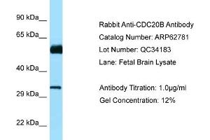 Western Blotting (WB) image for anti-Cell Division Cycle 20B (CDC20B) (N-Term) antibody (ABIN2789244) (CDC20B Antikörper  (N-Term))