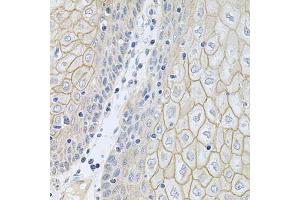 Immunohistochemistry of paraffin-embedded human esophagus using NCR3 antibody (ABIN5974302) at dilution of 1/100 (40x lens). (NCR3 Antikörper)