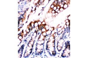 Anti-Fatty Acid Binding Protein 5 antibody, IHC(P) IHC(P): Rat Intestine Tissue
