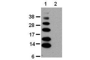 anti-K63-Linked Polyubiquitin antibody