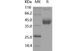 Western Blotting (WB) image for Activated Leukocyte Cell Adhesion Molecule (ALCAM) (Active) protein (His tag,Fc Tag) (ABIN7320443) (CD166 Protein (His tag,Fc Tag))