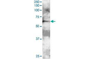 GRB7 polyclonal antibody  staining (2 ug/mL) of A-431 lysate (RIPA buffer, 30 ug total protein per lane). (GRB7 Antikörper)