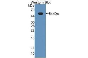 Detection of Recombinant Kim1, Human using Polyclonal Antibody to Kidney Injury Molecule 1 (Kim1) (HAVCR1 Antikörper  (AA 21-240))