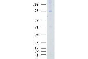 Western Blotting (WB) image for AXL Receptor tyrosine Kinase (AXL) (Transcript Variant 1) protein (Myc-DYKDDDDK Tag) (ABIN2715089)