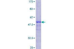 Image no. 1 for Dickkopf Homolog 1 (DKK1) (AA 1-266) protein (GST tag) (ABIN1351647) (DKK1 Protein (AA 1-266) (GST tag))