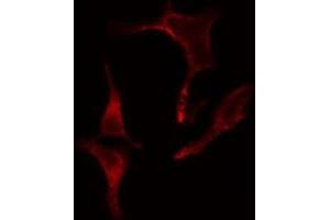 ABIN6275641 staining LOVO cells by IF/ICC. (EIF2B4 Antikörper  (Internal Region))
