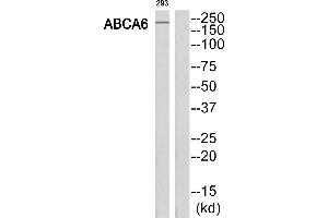Western blot analysis of extracts from 293 cells, using ABCA6 antibody.