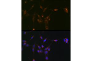 Immunofluorescence analysis of NIH/3T3 cells using PDLIM1/CLP36 Rabbit mAb (ABIN7269195) at dilution of 1:100 (40x lens). (PDLIM1 Antikörper)