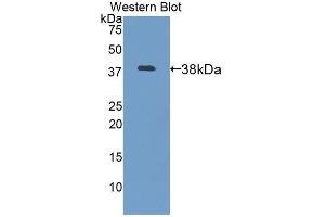 Detection of Recombinant LUM, Mouse using Polyclonal Antibody to Lumican (LUM) (LUM Antikörper  (AA 19-338))