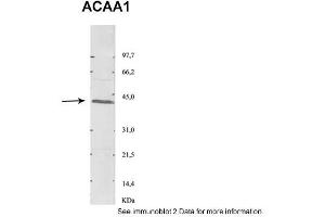 Sample Type: 1. (ACAA1 Antikörper  (N-Term))