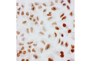 Immunohistochemistry (IHC) image for anti-Splicing Factor 1 (SF1) (AA 11-30), (N-Term) antibody (ABIN3044091)