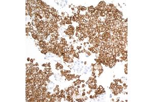 Immunohistochemistry (IHC) image for anti-CD163 (CD163) (AA 850-900) antibody (ABIN7448890) (Rekombinanter CD163 Antikörper  (AA 850-900))
