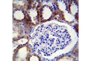 Caspase-3 antibody immunohistochemistry analysis in formalin fixed and paraffin embedded human kidney tissue.
