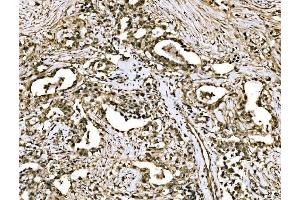 IHC analysis of WAPL/FOE using anti-WAPL/FOE antibody (ABIN7602663). (WAPAL Antikörper  (AA 916-1190))