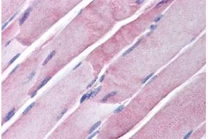 Human Skeletal Muscle (formalin-fixed, paraffin-embedded) stained with GOT2 antibody ABIN291150 at 20 ug/ml followed by biotinylated secondary antibody, alkaline phosphatase-streptavidin and chromogen. (GOT1 Antikörper)