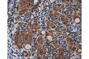 Immunohistochemical staining of paraffin-embedded Kidney tissue using anti-KIAA1609 mouse monoclonal antibody. (KIAA1609 Antikörper)