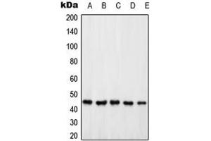 Western blot analysis of PSMD6 expression in HeLa (A), Jurkat (B), HEK293T (C), SP2/0 (D), PC12 (E) whole cell lysates. (PSMD6 Antikörper  (Center))