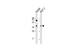 GNA12 anticorps  (AA 46-75)