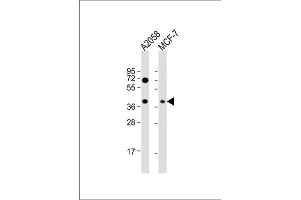 GNA12 anticorps  (AA 46-75)