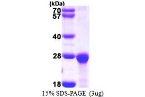 SDS-PAGE (SDS) image for PEST Proteolytic Signal Containing Nuclear Protein (PCNP) (AA 1-178) protein (His tag) (ABIN667948)