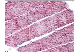 Human Skeletal Muscle: Formalin-Fixed, Paraffin-Embedded (FFPE) (FH Antikörper  (Internal Region))
