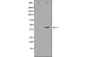 Western blot analysis of K562 whole cell lysates, using HIF1AN Antibody. (HIF1AN Antikörper  (C-Term))
