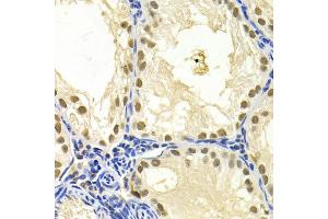 Immunohistochemistry of paraffin-embedded mouse testis using DDB1 Antibody (ABIN5971498) at dilution of 1/200 (40x lens).