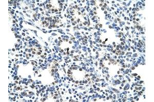 CBX3 antibody was used for immunohistochemistry at a concentration of 4-8 ug/ml to stain Alveolar cells (arrows) in Human Lung. (CBX3 Antikörper  (Middle Region))
