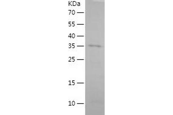 Somatostatin Protein (SST) (AA 1-116) (His-IF2DI Tag)