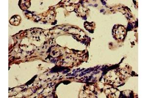Immunohistochemistry of paraffin-embedded human placenta tissue using ABIN7153247 at dilution of 1:100 (FURIN Antikörper  (AA 520-701))