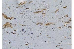 ABIN6276294 at 1/100 staining Human lung tissue by IHC-P. (BID Antikörper  (C-Term))