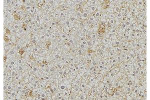 ABIN6274865 at 1/100 staining Mouse liver tissue by IHC-P. (Arylsulfatase A Antikörper  (Internal Region))