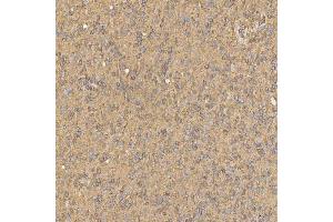 IHC analysis of SNX4 using anti-SNX4 antibody (ABIN7599406). (Sorting Nexin 4 Antikörper  (AA 1-450))