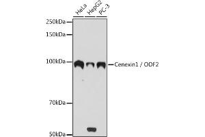 Western blot analysis of extracts of various cell lines, using Cenexin1 / ODF2 antibody (ABIN1680357, ABIN3017873, ABIN3017874 and ABIN7101531) at 1:1000 dilution. (ODF2 Antikörper)