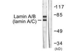 Western blot analysis of extracts from HeLa cells, using Lamin A/C (Ab-392) Antibody.