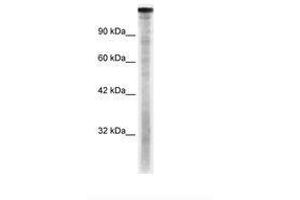 Image no. 2 for anti-TAF1 RNA Polymerase II, TATA Box Binding Protein (TBP)-Associated Factor, 250kDa (TAF1) (C-Term) antibody (ABIN6735891) (TAF1 Antikörper  (C-Term))