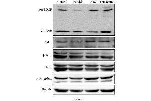 Representative Western blot analysis (a) and immunohistochemical staining (b) of BDNF, TrkB, p-ERK, ERK, and β-arrestin 2 in the hippocampus. (TRKB Antikörper  (AA 401-500))