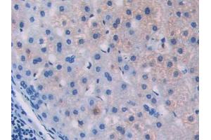 Used in DAB staining on fromalin fixed paraffin- embedded stomach tissue (IL18R1 Antikörper  (AA 147-255))
