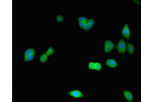 Immunofluorescence staining of HepG2 cells with ABIN7148865 at 1:266, counter-stained with DAPI. (CDK2 Antikörper  (AA 1-298))