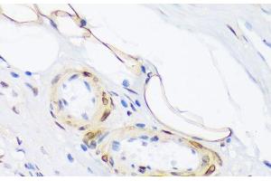 Immunohistochemistry of paraffin-embedded Human appendix using Phospho-PLN(T17) Polyclonal Antibody at dilution of 1:100 (40x lens). (Phospholamban Antikörper  (pThr17))