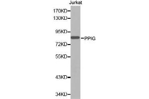 Western blot analysis of extracts of Jurkat cell line, using PPIG antibody. (PPIG Antikörper  (AA 1-100))